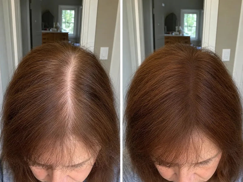 Carolyn V. auburn before and after part coverage with Standora hair density powder