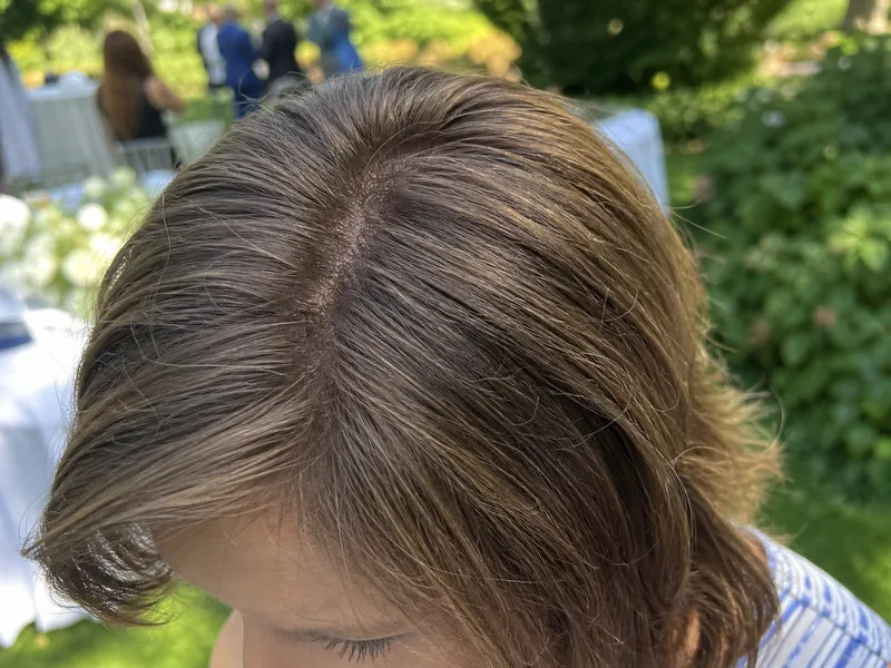 Anna C. outdoor humidity hair part result with Standora coverage