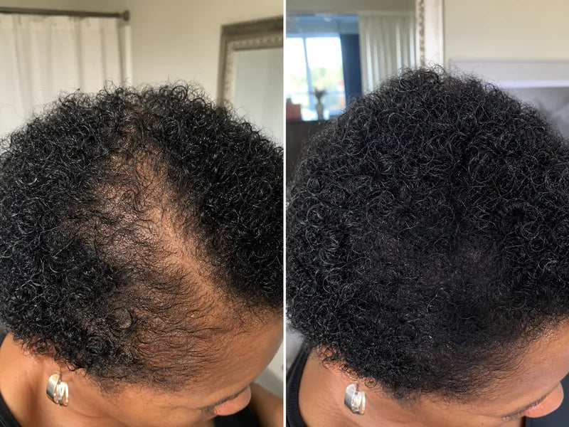 Gloria P. black curly hair before and after coverage with Standora hair density powder