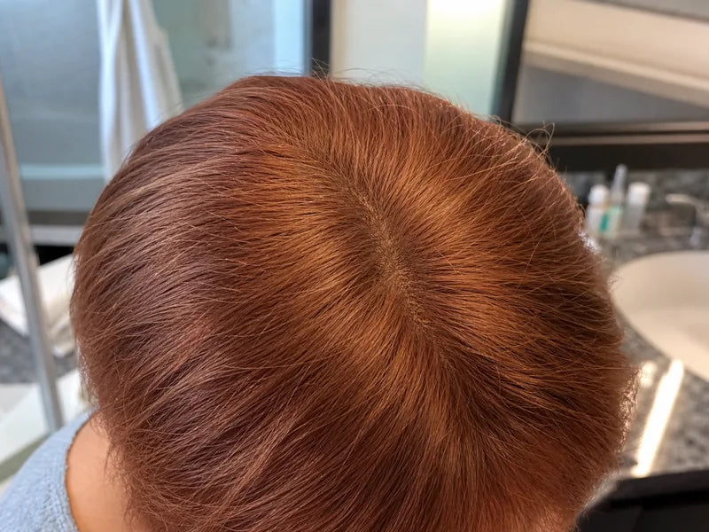 Patricia K. copper travel bathroom result after using Standora hair density powder